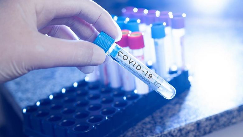 Regjistrohet numër rekord i të shëruarve nga coronavirus në Maqedoni