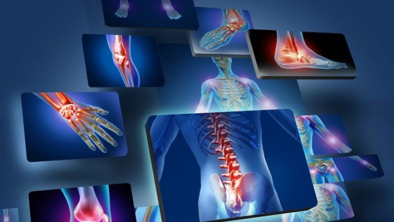 Artriti reumatoid – Pasojë e mungesës së proteinës specifike