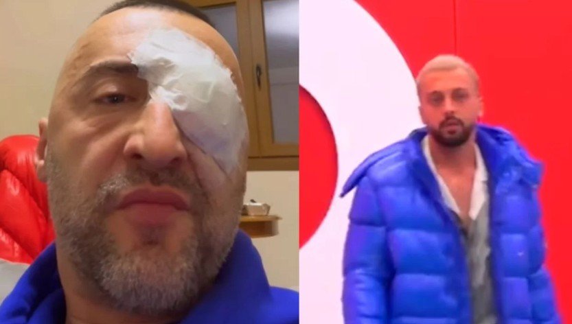  G-Bani shfaqet i përlotur, i del në krahë Gjestit: Nuk e meritoje, kam bërë gabim që…