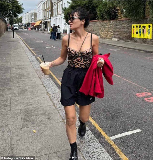 Lily Allen provokon me të brendshme të kuqe, tregon me krenari rezultatet e operacionit të gjoksit