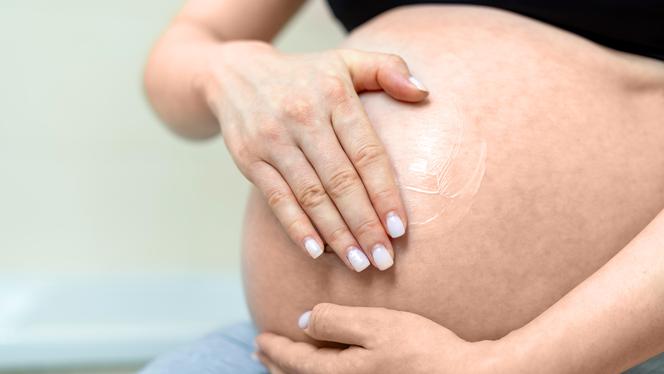 A mund të ndihmojë vërtet vazelina për të hequr strijat gjatë shtatzënisë?