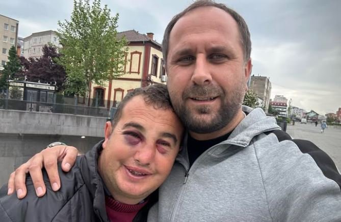 Sulmohet një person me aftësi të kufizuara në Ferizaj