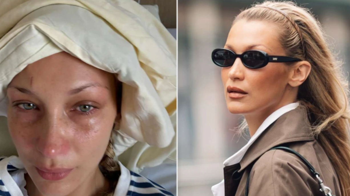 Bella Hadid flet hapur për betejën e gjatë me depresionin: E nisja çdo ditë me lot