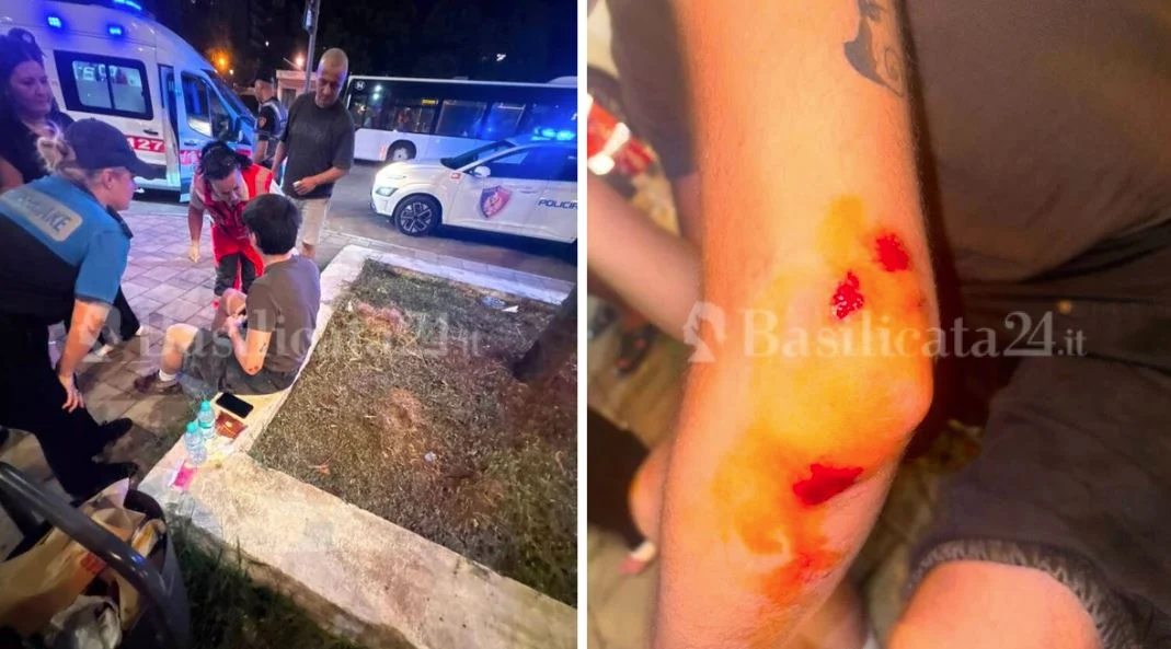 “Policia nuk reagoi, na dhunuan në mes të sheshit”, denoncimi i turistëve italianë për dhunë nga disa të rinj në Tiranë