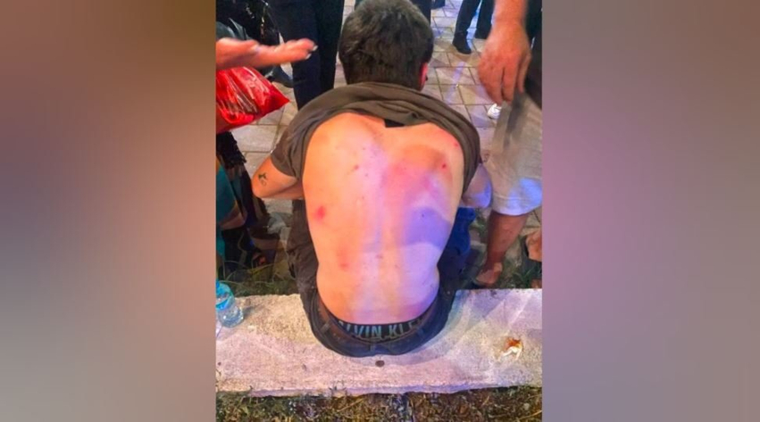 Denoncimi i turistëve italianë për një konflikt në Tiranë  reagon Policia  Njëri prej tyre u përplas me një grup të miturish  rasti po hetohet