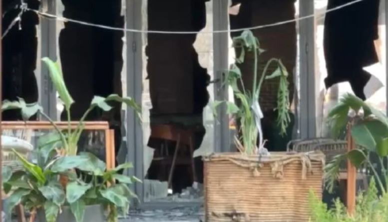 U dogj nga zjarri në një hotel në Vlorë, 25-vjeçarja dërgohet për trajtim në Turqi