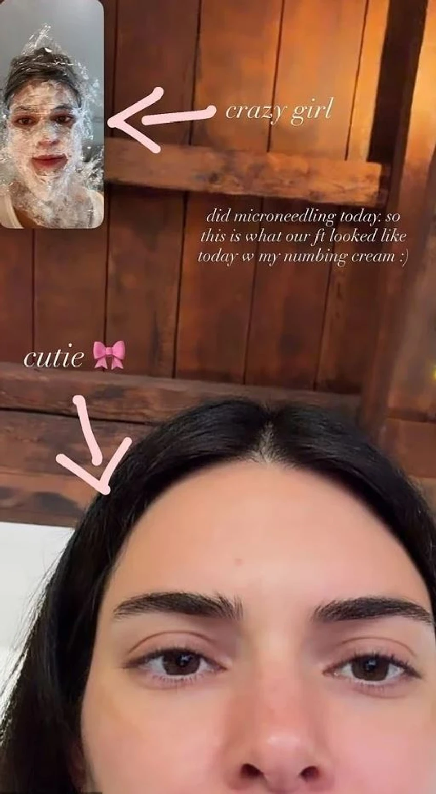 “Vajzë e çmendur”, Kylie Jenner habit fansat me pamjen gjatë trajtimit të fytyrës 2 Image