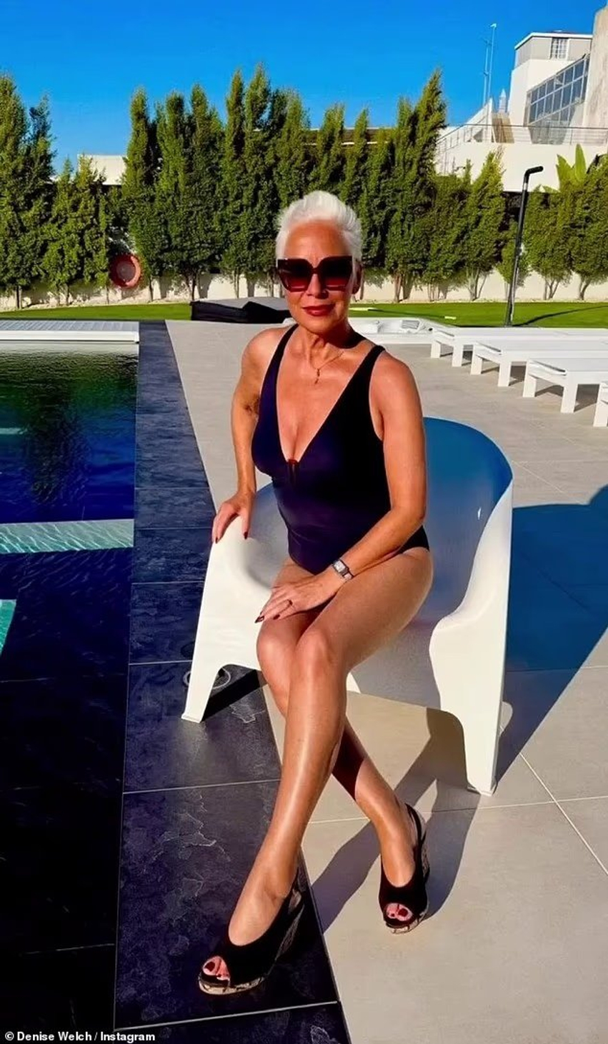 Denise Welch mahnit me bikini të zeza pas largimit nga  Loose Women 