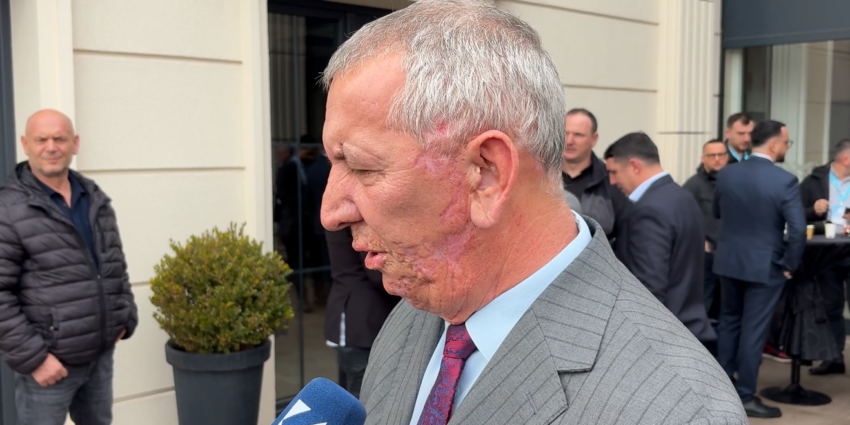 Quni: Dorëheqja e kryetarit i hap rrugë kandidaturave të reja, vendimi i Kuvendit përcakton procedurat