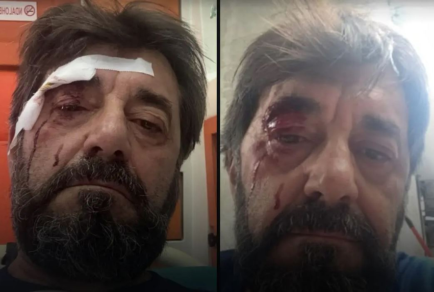 Sulmohet Ilir Demalia  analisti kallëzon në polici  Më sulmuan dy persona