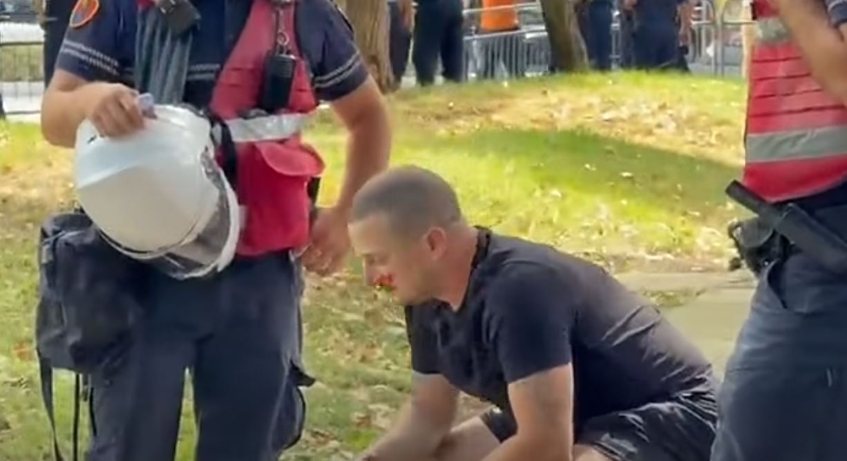 Berisha: Përgjaket protesta. Pasi e përgjakin narkopolicët lajnë duart si Pilati!