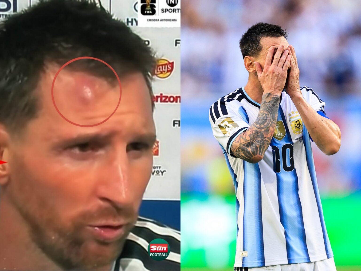 Messi pësoi një lëndim 