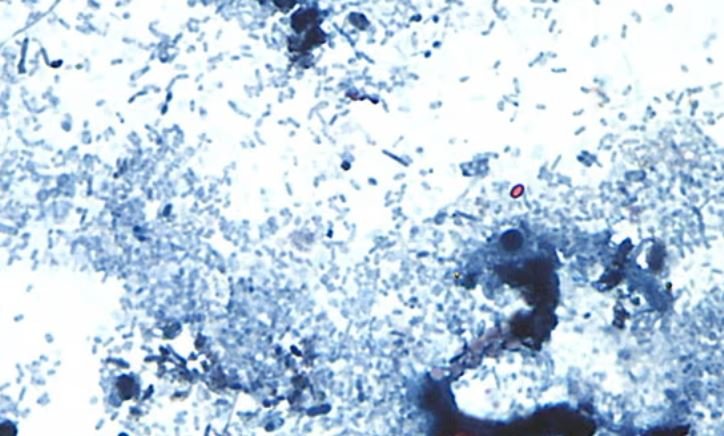 Zyrtarët e shëndetësisë në Michigan identifikojnë ‘shkaktarin e mundshëm’ të helmimit nga ushqimi