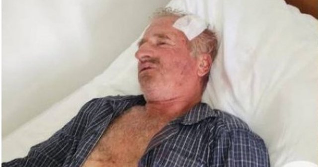Tropojë/ Konflikti mes fqinjëve përfundon me dh*nimin e një 60-vjeçari, dërgohet te Trauma 