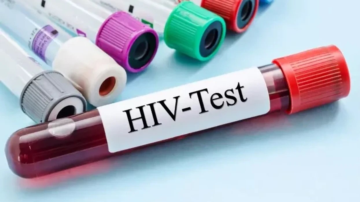 Dhjetë raste të reja me HIV në muajt e fundit, dy viktima - rritet testimi vullnetar