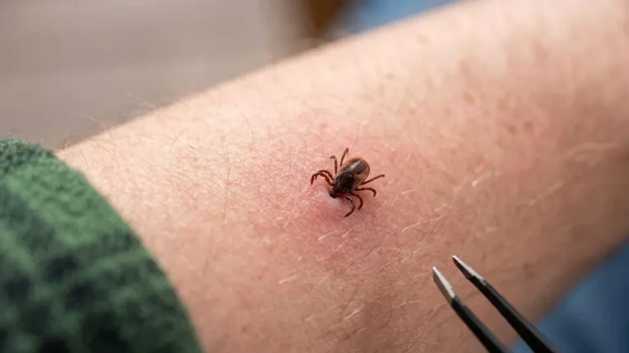 Rriqra nuk transmeton vetëm sëmundjen Lyme: Mund të shkaktojë alergji të rrezikshme ndaj mishit