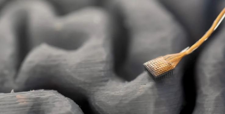 Inteligjenca artificiale “lexon” mendimet