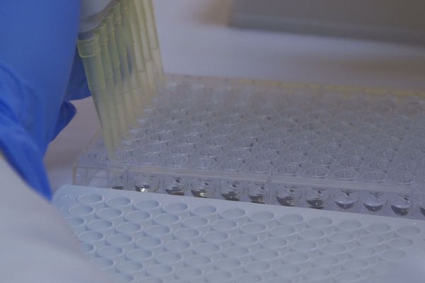 ​Një pikë gjaku që shpëton jetë, dy foshnja të diagnostikuara me fibrozë cistike në QKUK