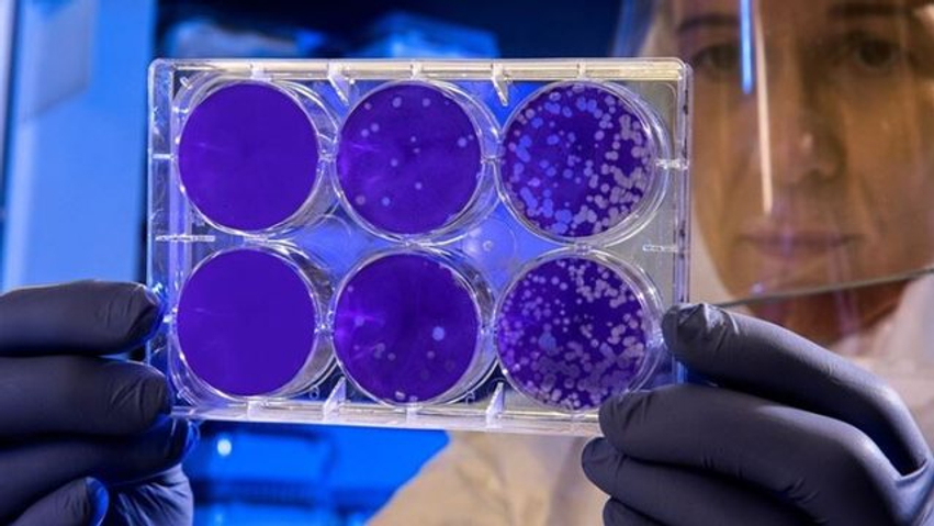 Hantavirusi vjen në Itali  Një 25 vjeçar me simptoma shtrohet në spital