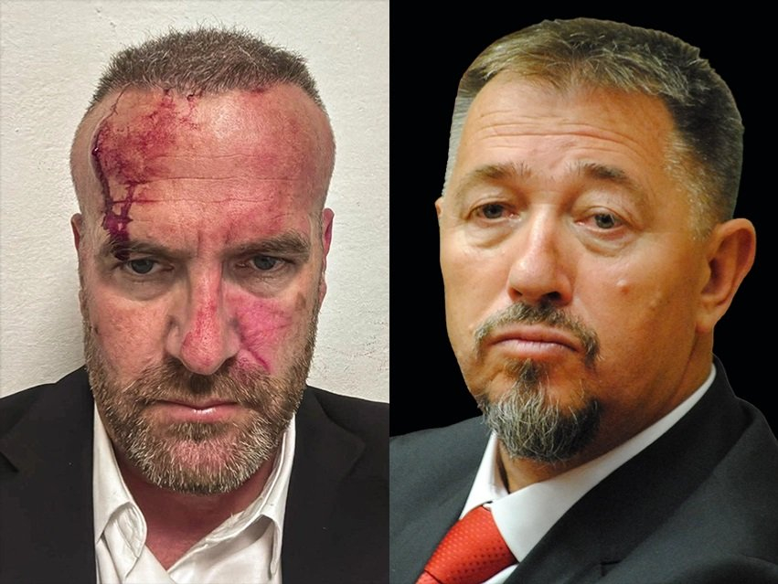 Deputetja e Vetëvendosjes  Sulmi i Sami Lushtakut  përpjekje për frikësim politik