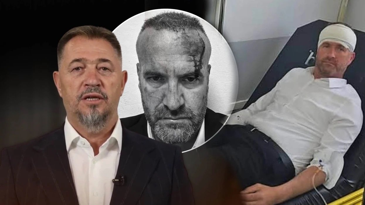 Dy të arrestuar për sulmin ndaj Hysni Mehanit në Skenderaj