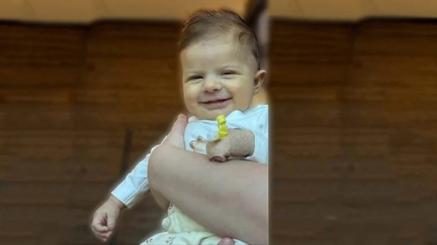 Apel për ndihmë  Hana 2 muajshe e gjysmë ka nevojë urgjente për shërim jashtë vendit