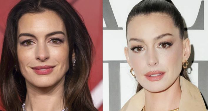 Anne Hathaway i përgjigjet thashethemeve për ndërhyrje estetike: “Nuk kam bërë lifting”