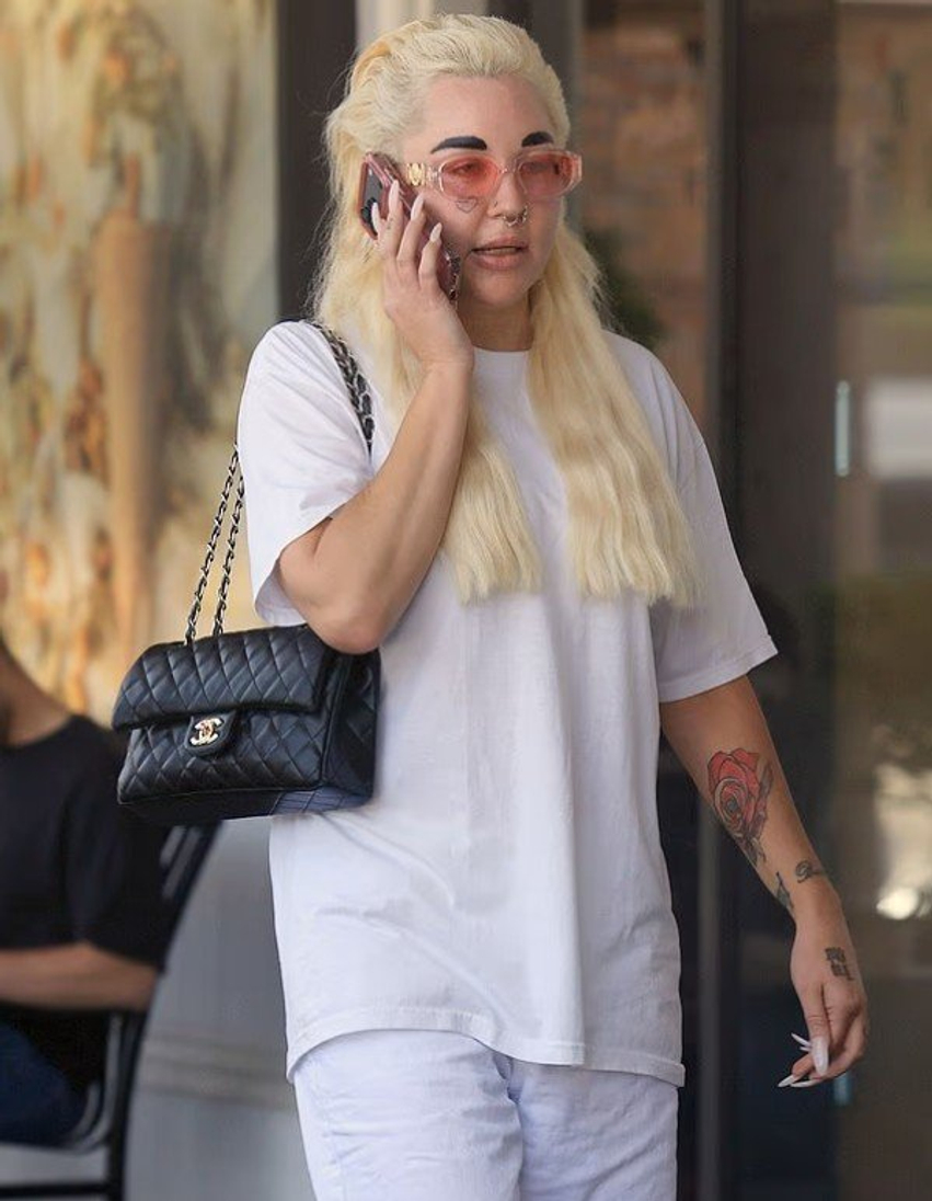 Amanda Bynes rikthen vetullat e zeza dhe vazhdon transformimin pas humbjes në peshë me Ozempic