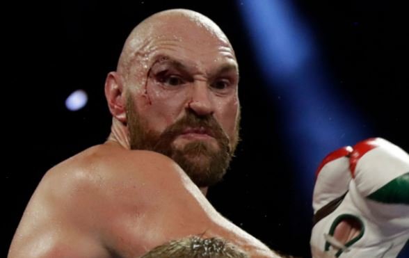 Tyson Fury rikthehet në ring me 1 gusht 
