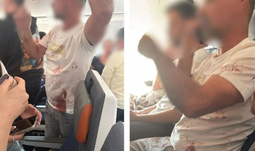 cnn-cfare-ndodhi-brenda-fluturimit-te-flydubai-per-ne-izrael