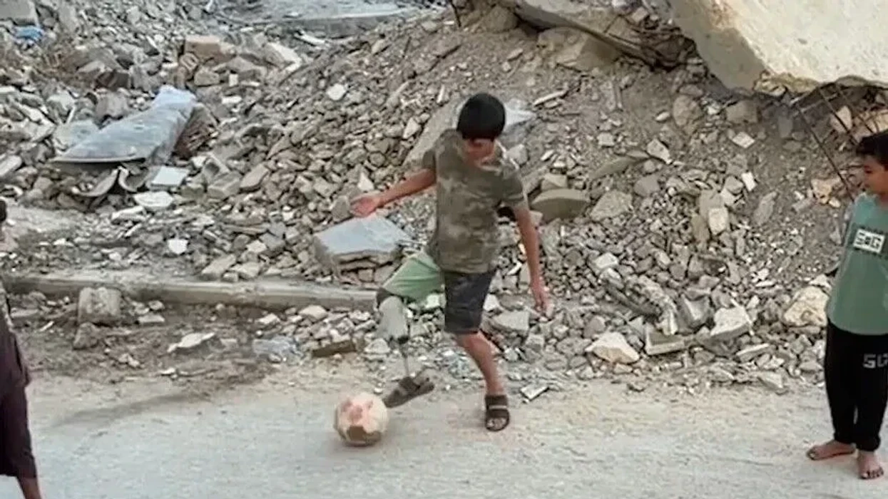 Humbi këmbën në sulm, 13-vjeçari nga Palestina vazhdon të luajë futboll me protezë