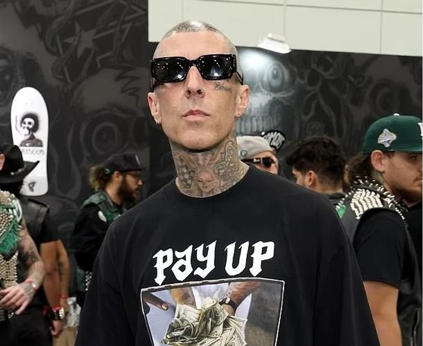 Travis Barker tregon gjendjen pas operacionit