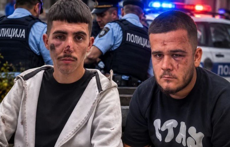 Shkup, dy të rinj shqiptarë dyshohet se u rrahën brutalisht nga policia