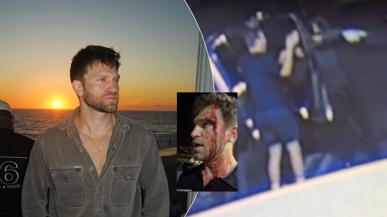 Ylli i “Pretty Little Liars”, Keegan Allen sulmohet pranë makinës, grabitësit i marrin orën