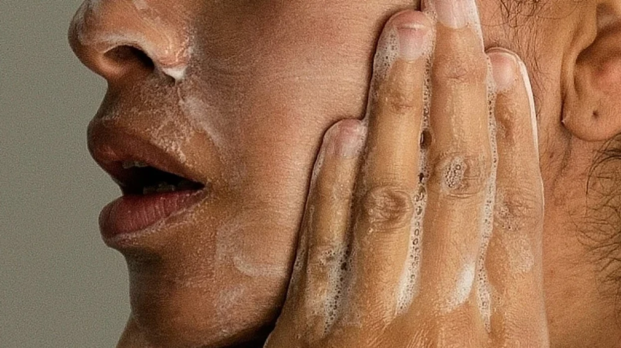 Aknet shfaqen edhe në moshë madhore, dermatologët tregojnë si mund të trajtohen