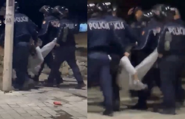 Pamje të rënda: Policia i thyen këmbën dhe e tërheq zvarrë një protestues në Tiranë