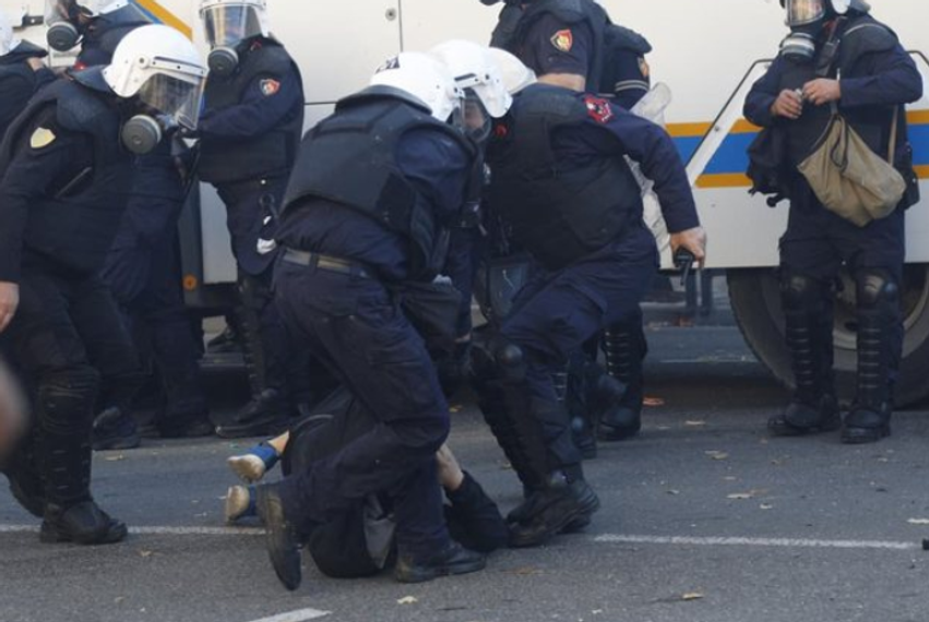Ka nderuar Shqipërinë në gjithë botën  kolonelja reagon kundër dhunës së policisë