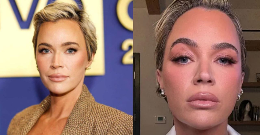teddi-mellencamp-kryen-nderhyrje-estetike-gjate-trajtimit-per-kancerin