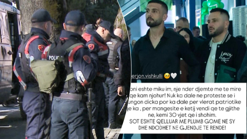 Bes Kallaku reagon pas plagosjes së mikut të tij në protestë  dyshohet se u godit në sy me plumb gome
