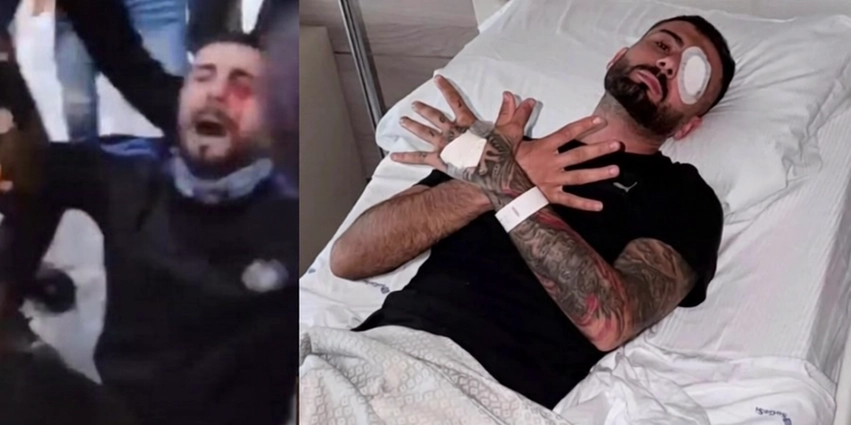 Mjekët në Romë bëjnë mrekullinë për shqiptarin  I shpëtojnë syrin