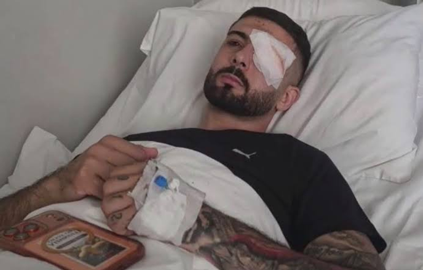 U plagos me plumb gome në sy gjatë protestës  Erjon Vishkulli kalon me sukses operacionin në Romë