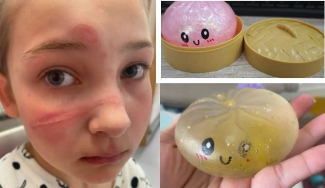 New York Post: Alarmi për lodrat e njohura “Squishy”, mijëra tërhiqen nga tregu në SHBA! Rrezik për lëndime serioze dhe vdekje te fëmijët