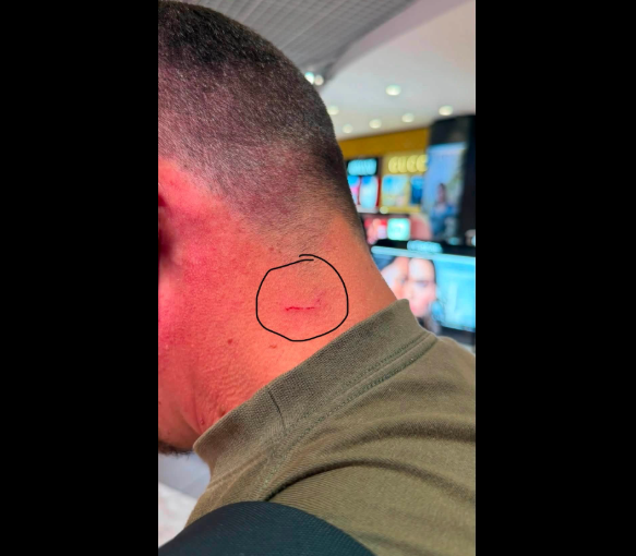 “Rama e kap me thonj emigrantin shqiptar”, Çim Peka publikon fotot dhe tregon çfarë pretendohet se ndodhi