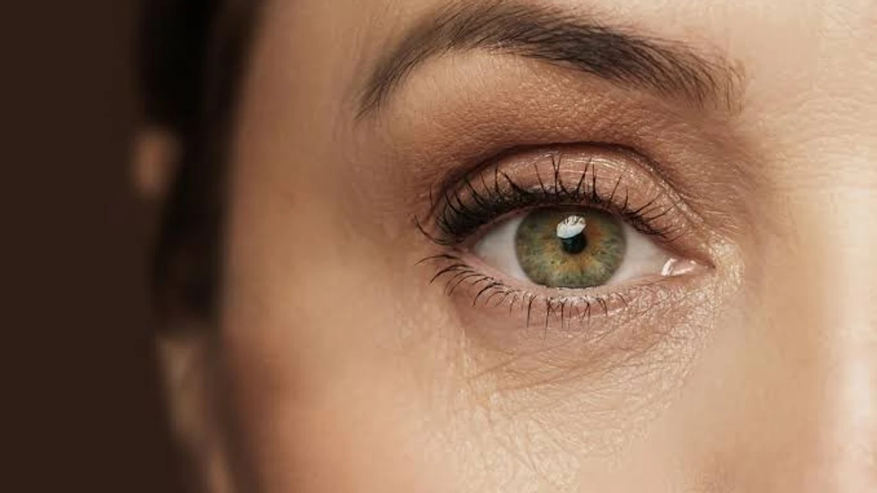 Rrudhat rreth syve shfaqen që në vitet e para, dermatologët zbulojnë se çfarë mund t'i zvogëlojë ato vërtet